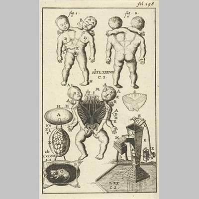 Jan Luyken Anatomische afbeelding VI